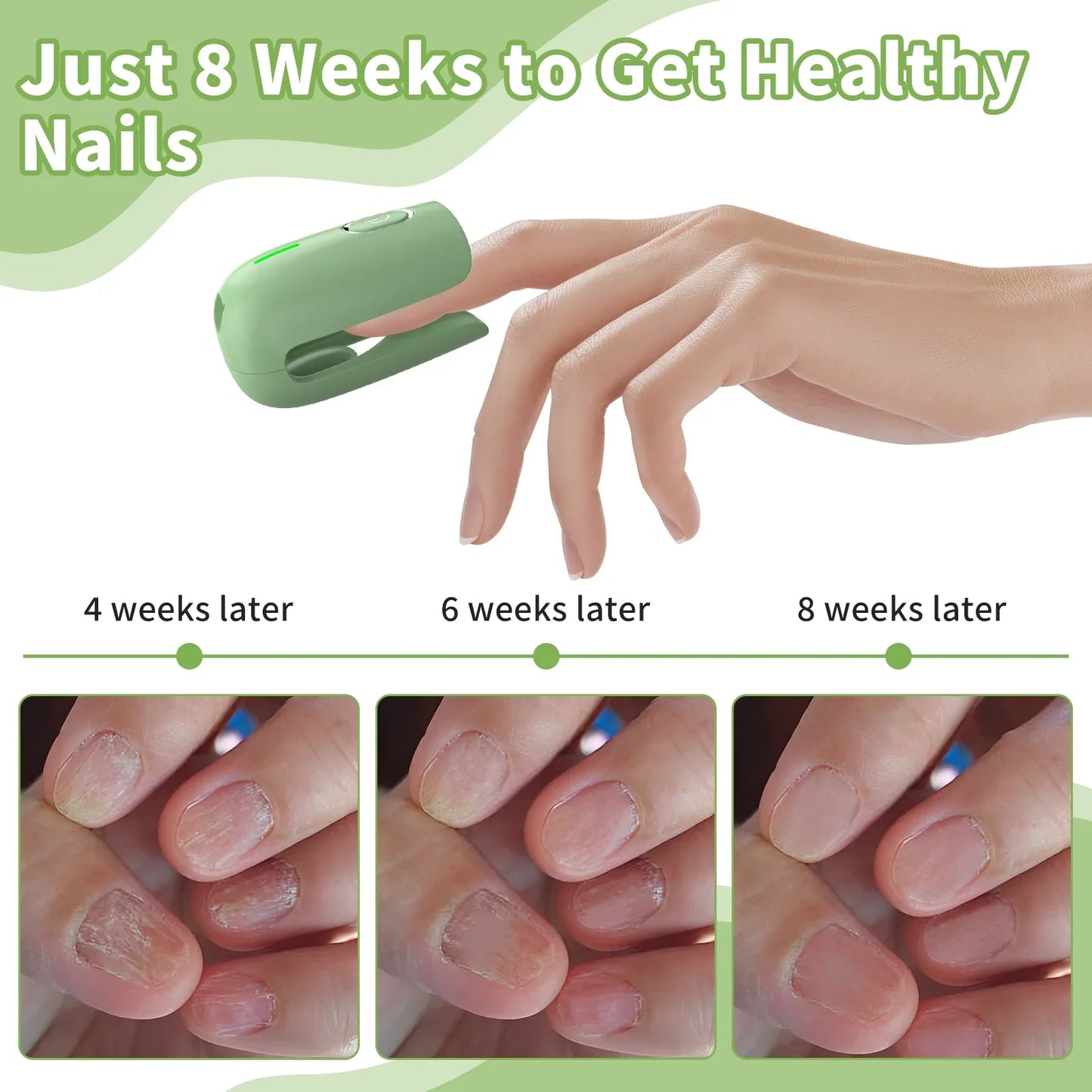 Nail Fungus Cleaning Device Portable Fungus Remover Machine