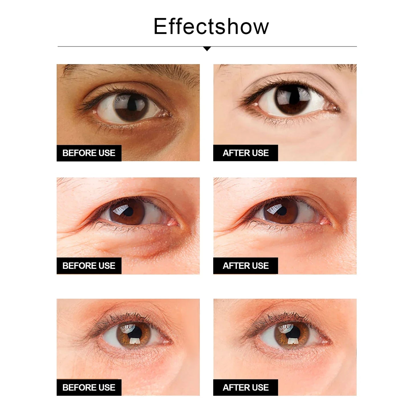 Snake Venom Eye Cream Reduces Fine Lines and Dark Circles